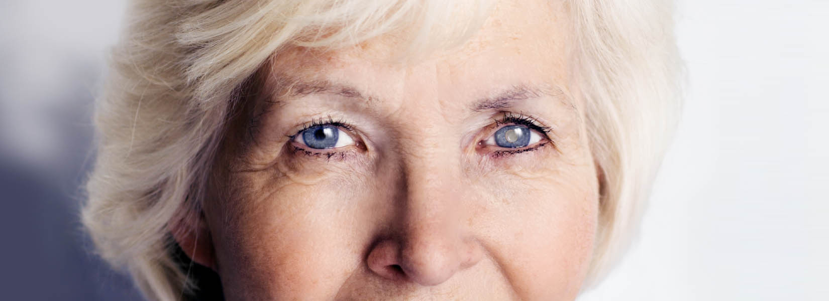Cataract Surgery in Ocala